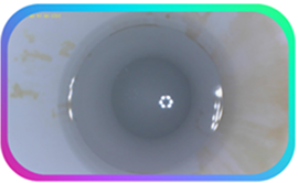 URIZAP-Shock-After-URIZAP-Shock